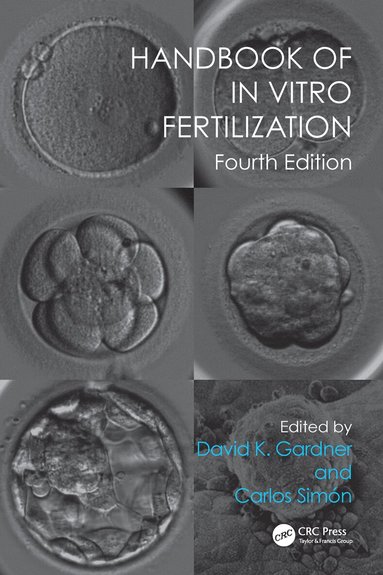 David K. Gardner, Carlos Simón - Handbook of In Vitro Fertilization, Inbunden