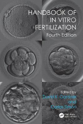 Handbook of In Vitro Fertilization 1