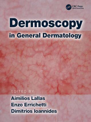 Aimilios Lallas, Enzo Errichetti, Dimitrios Ioannides - Dermoscopy in General Dermatology, Inbunden