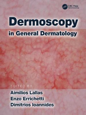 bokomslag Dermoscopy in General Dermatology