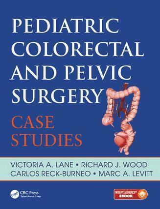 Victoria Lane, Richard Wood, Carlos Reck, Marc Levitt - Pediatric Colorectal and Pelvic Surgery, Inbunden