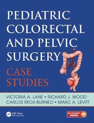 bokomslag Pediatric Colorectal and Pelvic Surgery