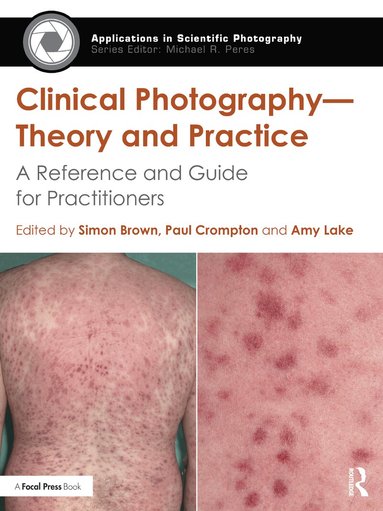 Simon Brown, Paul Crompton, Amy Lake - Clinical Photography — Theory and Practice, Häftad