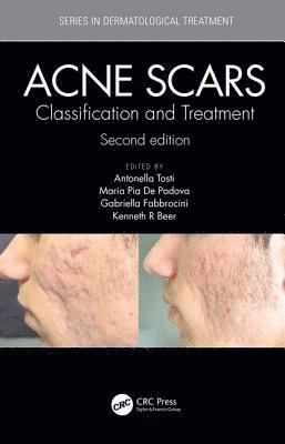 bokomslag Acne Scars