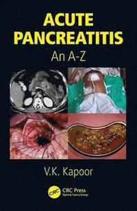 bokomslag Acute Pancreatitis