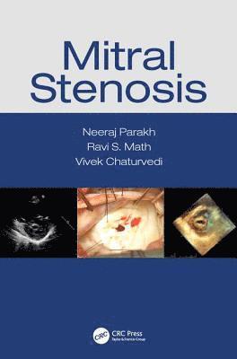 Mitral Stenosis 1