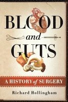 bokomslag Blood and Guts: A History of Surgery