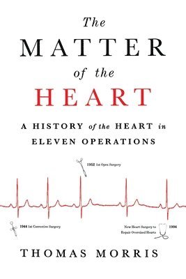 The Matter of the Heart: A History of the Heart in Eleven Operations 1
