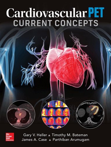 Gary Heller, Timothy M Bateman, James A Case, Parthiban Arumugam - Cardiovascular PET: Current Concepts, Inbunden