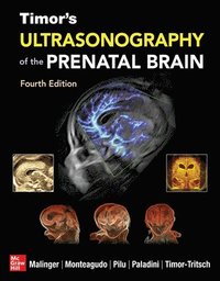 bokomslag Timor's Ultrasonography of the Prenatal Brain, Fourth Edition