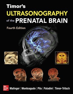 Gustavo Malinger, Ana Monteagudo, Gianluigi Pilu, Ilan Timor-Tritsch, Dario Paladini - Timor's Ultrasonography of the Prenatal Brain, Fourth Edition, Inbunden