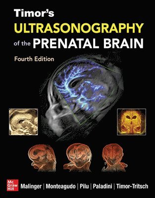 Timor's Ultrasonography of the Prenatal Brain, Fourth Edition 1