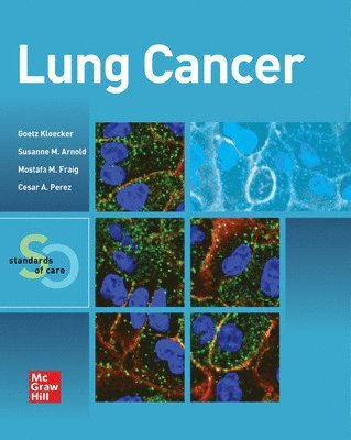 Goetz Kloecker, Mostafa Fraig, Susanne M. Arnold, Cesar A. Perez - Lung Cancer:  Standards of Care, Häftad