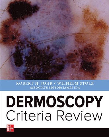 bokomslag Dermoscopy  Criteria Review