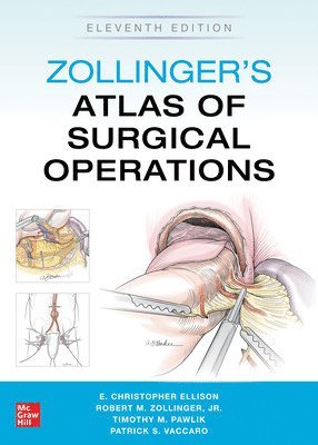 Robert Zollinger, E. Ellison, Timothy Pawlik, Patrick Vaccaro - Zollinger's Atlas of Surgical Operations, Eleventh Edition, Häftad