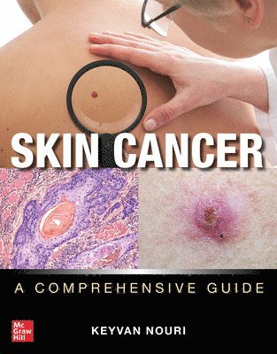 Keyvan Nouri - Skin Cancer: A Comprehensive Guide, Häftad