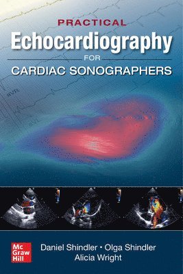Daniel Shindler, Daniel M. Shindler - Practical Echocardiography for Cardiac Sonographers, Häftad