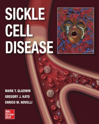 bokomslag Sickle Cell Disease