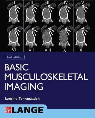 Jamshid Tehranzadeh - Basic Musculoskeletal Imaging, Second Edition, Häftad