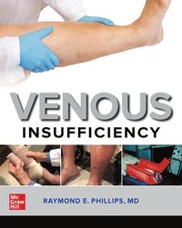 bokomslag Venous Insufficiency