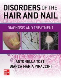 bokomslag Disorders of the Hair and Nail: Diagnosis and Treatment