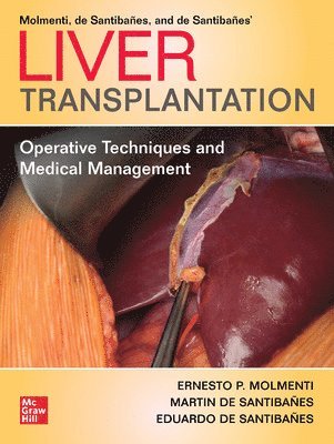 bokomslag Liver Transplantation: Operative Techniques and Medical Management