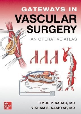 bokomslag Gateways in Vascular Surgery: An Operative Atlas