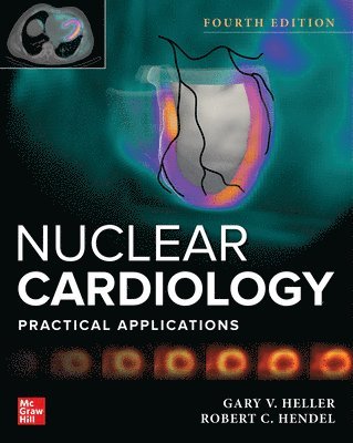 Gary Heller, Robert Hendel - Nuclear Cardiology: Practical Applications, Fourth Edition, Inbunden