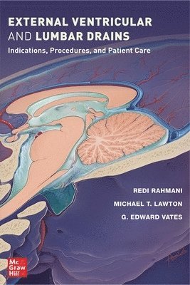 Redi Rahmani, Michael T. Lawton, G. Edward Vates, Michael T Lawton, G Edward Vates - External Ventricular and Lumbar Drains: Indications, Procedures, and Patient Care, Häftad