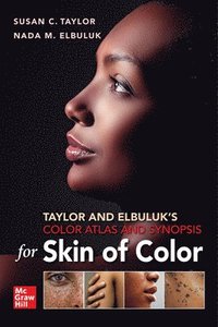 bokomslag Taylor and Elbuluk's Color Atlas and Synopsis for Skin of Color