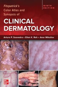 bokomslag Fitzpatrick's Color Atlas and Synopsis of Clinical Dermatology, Ninth Edition