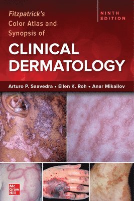 Arturo Saavedra, Ellen Roh, Anar Mikailov, Arturo P. Saavedra, Ellen K. Roh - Fitzpatrick's Color Atlas and Synopsis of Clinical Dermatology, Ninth Edition, Häftad
