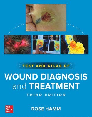 bokomslag Text and Atlas of Wound Diagnosis and Treatment, Third Edition