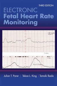bokomslag Electronic Fetal Heart Rate Monitoring: the 5-Tier System