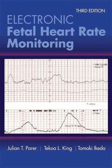 bokomslag Electronic Fetal Heart Rate Monitoring: The 5-Tier System