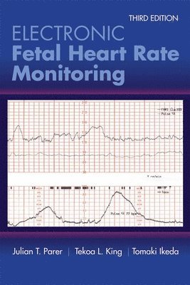 Electronic Fetal Heart Rate Monitoring 1