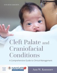 bokomslag Cleft Palate And Craniofacial Conditions: A Comprehensive Guide To Clinical Management