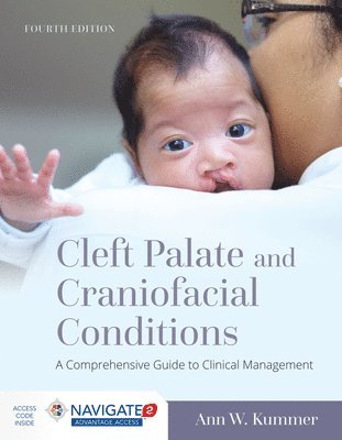 bokomslag Cleft Palate and Craniofacial Conditions: A Comprehensive Guide to Clinical Management