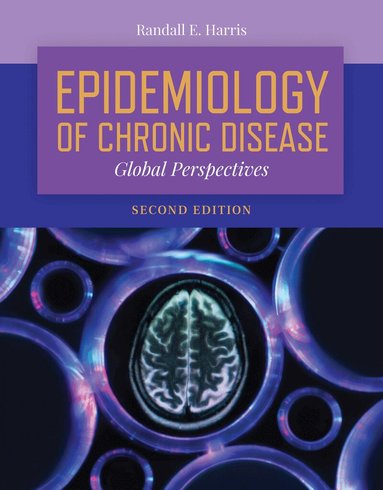 Randall E. Harris - Epidemiology of Chronic Disease: Global Perspectives, Häftad
