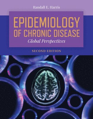 bokomslag Epidemiology of Chronic Disease: Global Perspectives