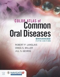 bokomslag Color Atlas Of Common Oral Diseases, Enhanced Edition