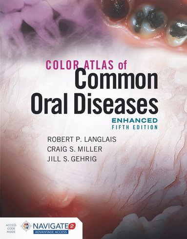 Robert P. Langlais, Craig S. Miller, Jill S. Gehrig - Color Atlas of Common Oral Diseases, Enhanced Edition, Häftad