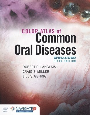Robert P. Langlais, Craig S. Miller, Jill S. Gehrig, Robert P Langlais, Craig S Miller, Jill S Gehrig - Color Atlas of Common Oral Diseases, Enhanced Edition, Häftad