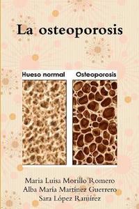 bokomslag La osteoporosis