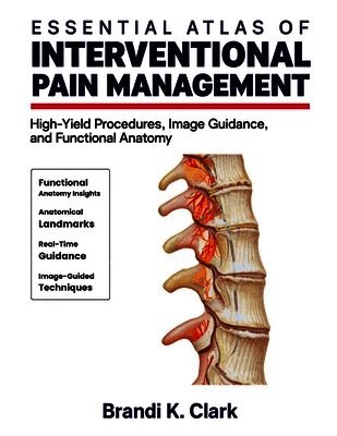 Essential Atlas of Interventional Pain Management: High-Yield Procedures, Image Guidance, and Functional Anatomy