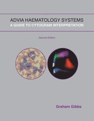 Graham Gibbs - Advia Haematology Systems: A Guide to Cytogram Interpretation, Häftad