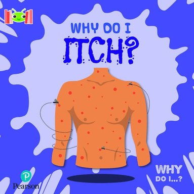 Kirsty Holmes - Bug Club Reading Corner: Age 5-7: Why Do I Itch?, Häftad