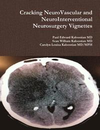 bokomslag Cracking NeuroVascular and NeuroInterventional Neurosurgery Vignettes