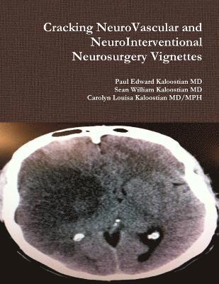 Cracking NeuroVascular and NeuroInterventional Neurosurgery Vignettes 1
