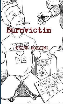 Burnvictim 1